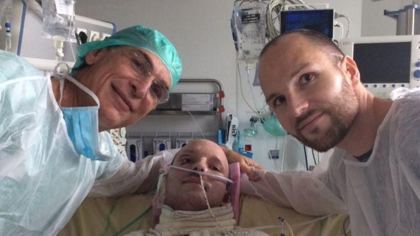 Geslaagde megatransplantatie: Fransman doneert helft van zijn huid aan verbrande tweelingbroer