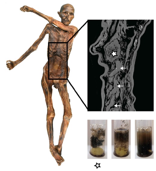 Ötzi, de ijsmummie uit het Ötztal