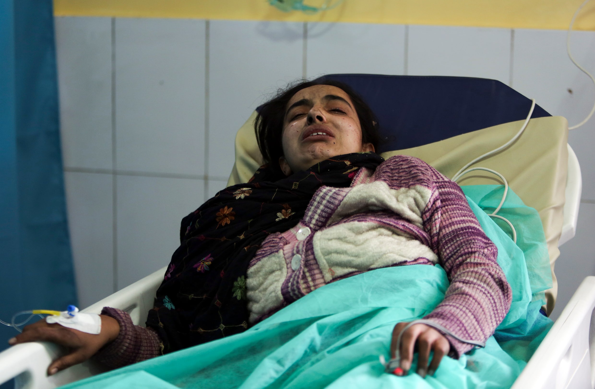 Een Afghaanse vrouw van de kleine Sikh-gemeenschap in het ziekenhuis in Kabul na de aanslag.