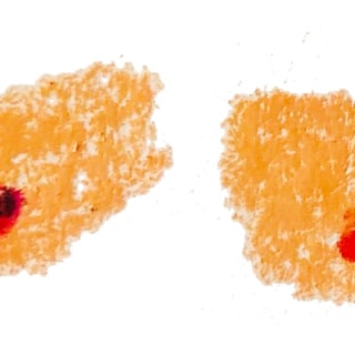 Welke zonnebrandcrème is het beste?
